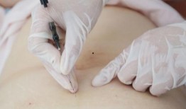 埋线减肥视频全过程,埋线减肥全过程揭秘